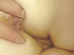 Analni gefingert